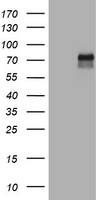 CD30 Antibody