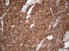 PIK3CA Antibody