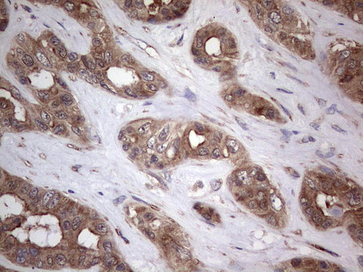 PIK3CA Antibody