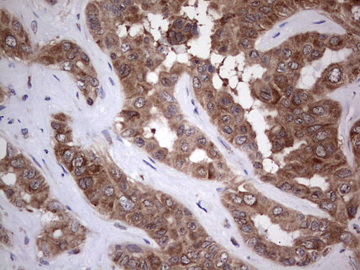 PIK3CA Antibody