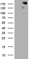ALK Antibody