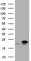 NM23A Antibody
