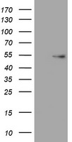 Vimentin Antibody