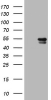 Vimentin Antibody