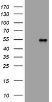 Vimentin Antibody