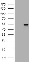 Vimentin Antibody