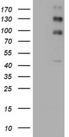 ALK Antibody