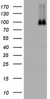 p95 NBS1 Antibody