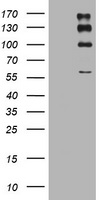 ALK Antibody