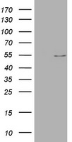 Vimentin Antibody