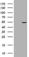 Vimentin Antibody
