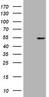 Vimentin Antibody