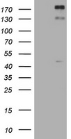 ALK Antibody