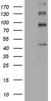 ALK Antibody