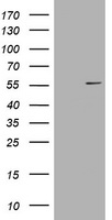 Vimentin Antibody