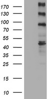 ALK Antibody