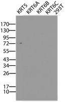 Cytokeratin 5 Antibody