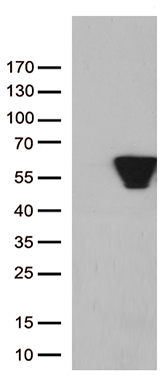 Vimentin Antibody