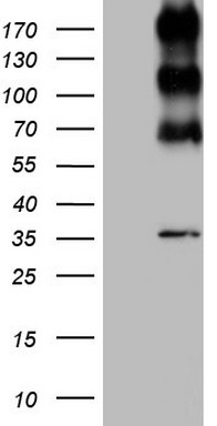 ALK Antibody