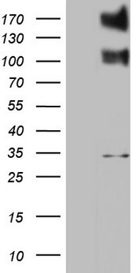 ALK Antibody