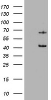 Cytokeratin 5 Antibody