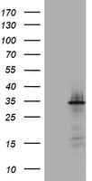 ABCB1 Antibody