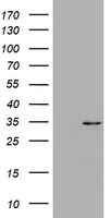 P Glycoprotein Antibody
