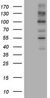ALK Antibody