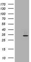 P Glycoprotein Antibody