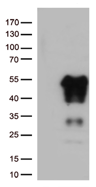 EMA Antibody