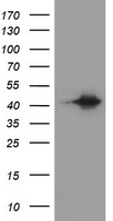 AMACR Antibody