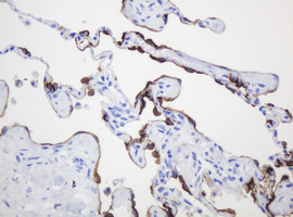 MUC1 Antibody