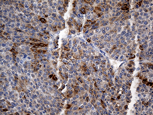 TFF1 Antibody