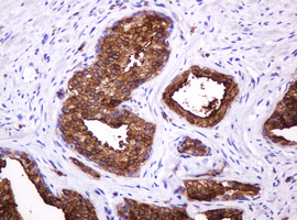 MUC1 Antibody
