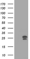 MGMT Antibody