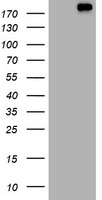 ALK Antibody