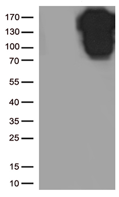 E Cadherin Antibody
