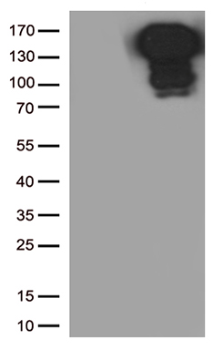 E Cadherin Antibody
