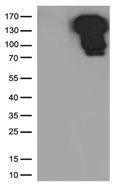 E Cadherin Antibody