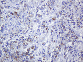 CD79A Antibody