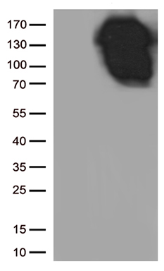 E Cadherin Antibody