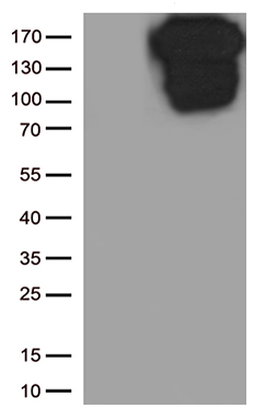 E Cadherin Antibody