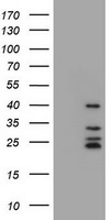 CD20 Antibody