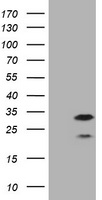 CD20 Antibody