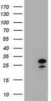 ZFAND5 Antibody