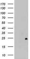 ZFAND5 Antibody