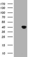 MAGEB1 Antibody