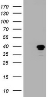 MAGEB1 Antibody