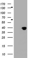 MAGEB1 Antibody