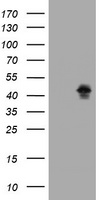 MAGEB1 Antibody